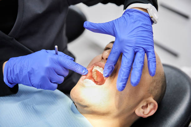 Best Broken or Chipped Tooth Repair in South Toms River, NJ